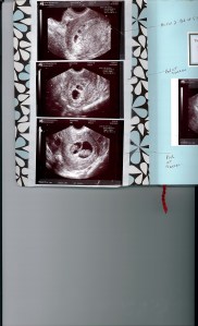 Sonogram Photos